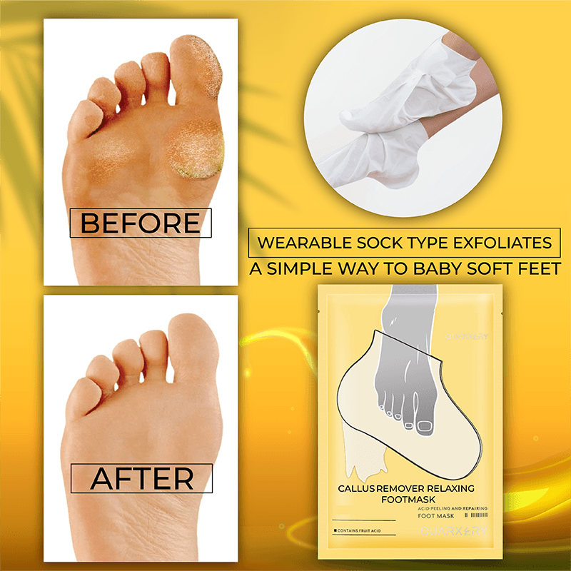 Callus Remover Relaxing Foot Mask